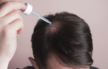 Applying liquid hair treatment to the crown of the scalp with a dropper.